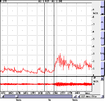 Dubravka envelope plot